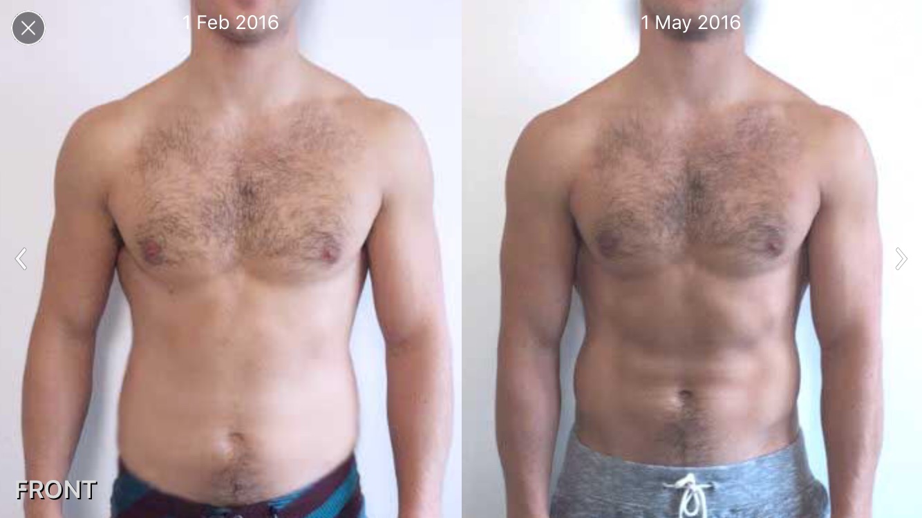 before-and-after-example-front-view