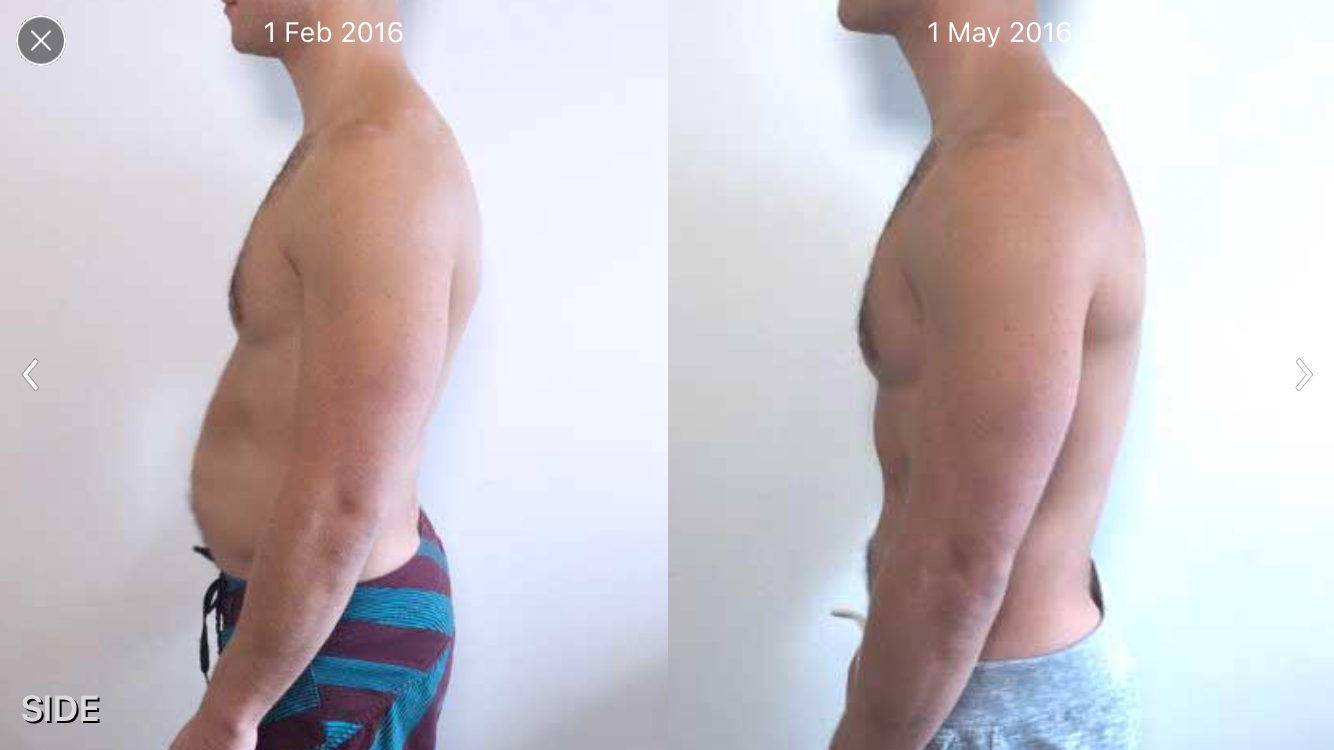 before-and-after-example-side-view